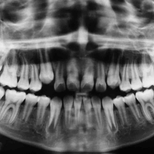 Radiografías Dentales